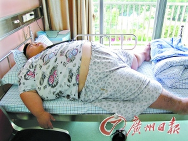 Không có thiết bị y tế nào vừa với người béo nhất Trung Quốc  